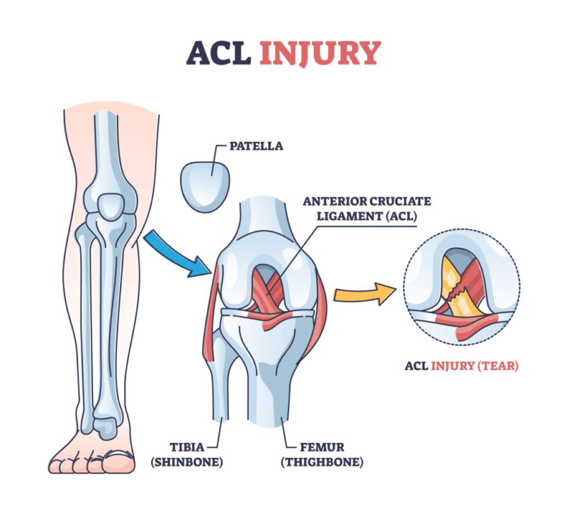 Most Common Injuries In Football And Their Causes most-common-injuries-in-football-and-their-causes